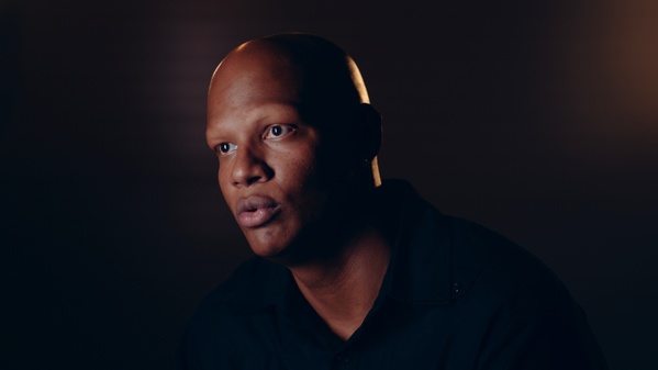 What is Alopecia